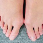 「外反母趾の予防と痛みの軽減する方法」