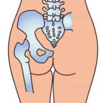 花小金井で急増中！ぎっくり腰の原因と対処法